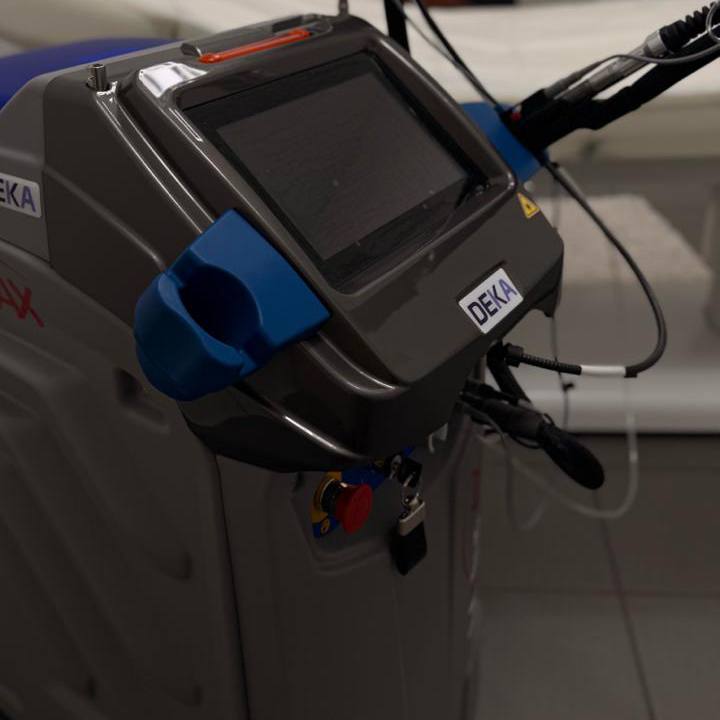 DEKA Moveo Alexandritlaser Gerät in der Praxis